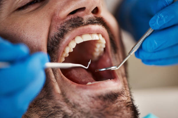 Best Emergency Treatment for Dental Infections or Abscesses in Blanco, TX
