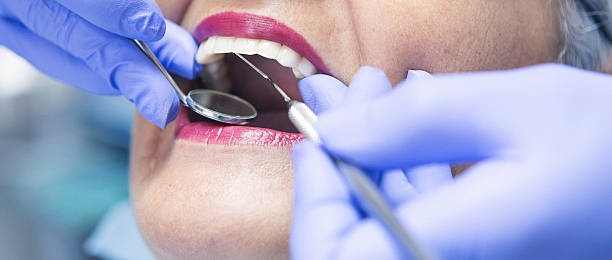 Best Emergency Tooth Extraction in Blanco, TX